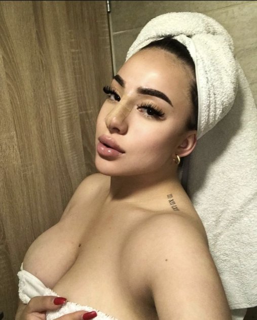 escorts