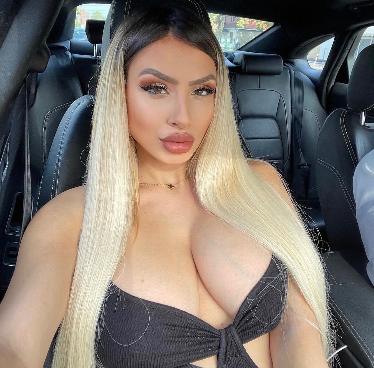 escorts