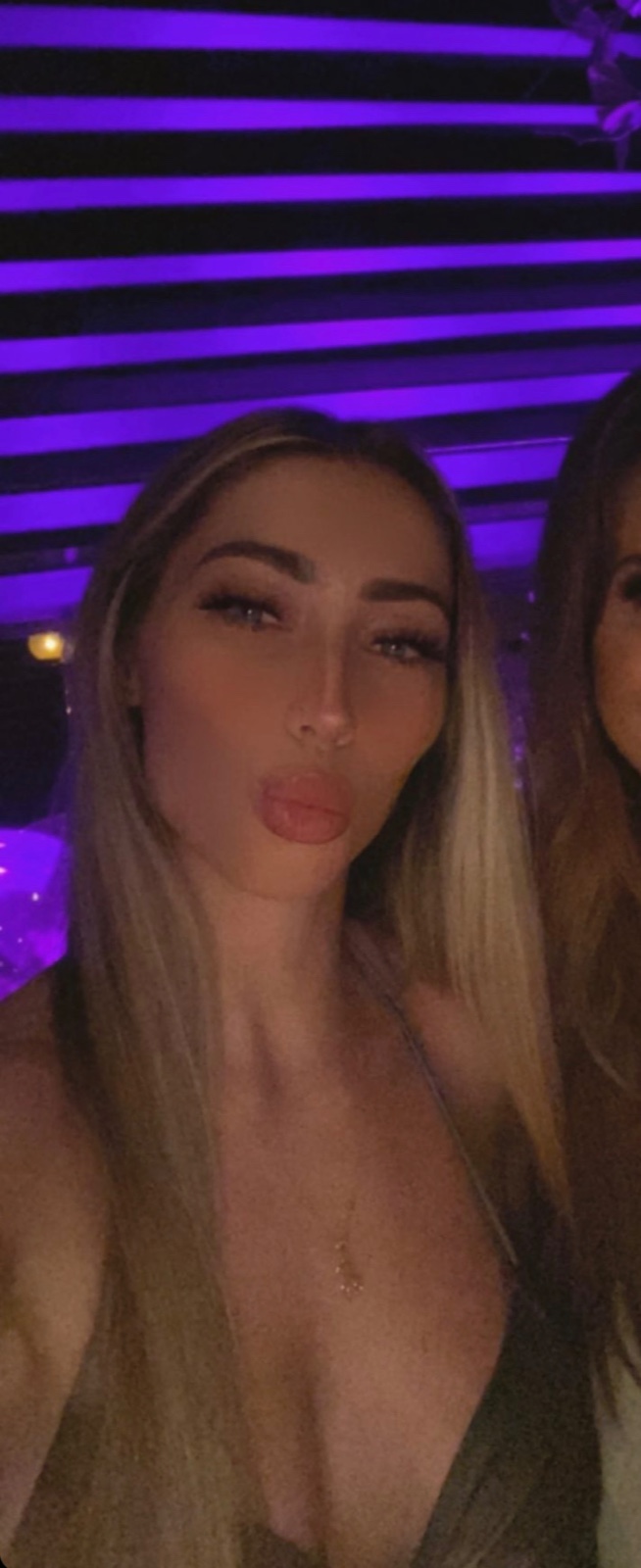 escorts
