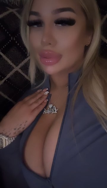 escorts