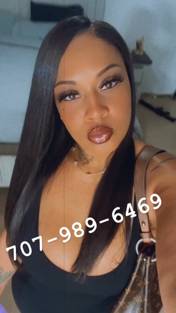 💎Exotic Zoey 💋!lElite Provider ✅ Super Busty Exotic Mix